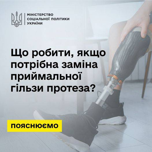 Спрощення процедури заміни частини протезу – актуальна інформація для захисників